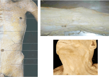 fascia1