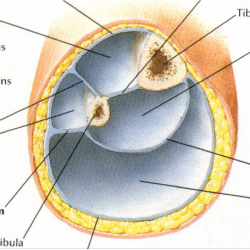 Fasciotomy