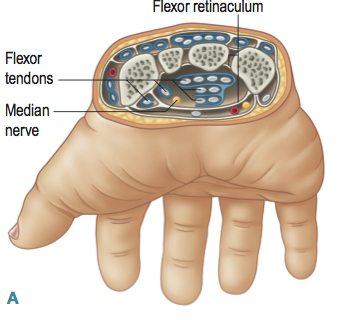 FIG7.17A