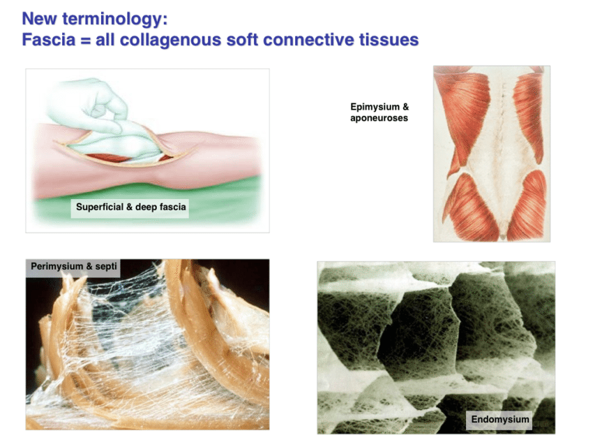 Fascia and ExtraCellular Matrix (ECM) Defining Fascia