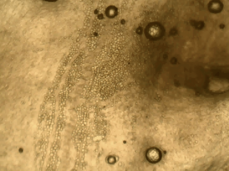 Fascia and Extra-Cellular Matrix (ECM) - Defining Fascia