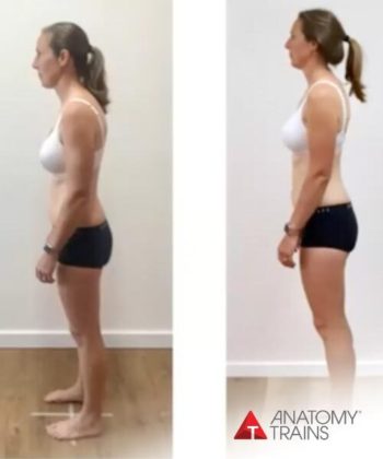 Before-and-after picture of a woman achieving better balanced and aligned posture.